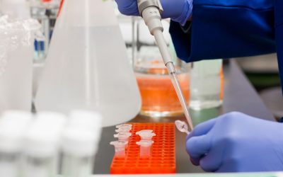 Plasma rico en plaquetas (PRP)