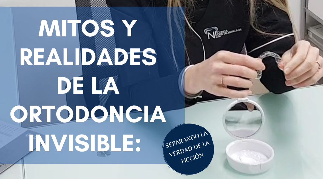 Mitos y realidades de la ortodoncia invisible: separando la verdad de la ficción