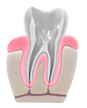 diente_endodoncia_intermedio
