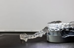Tratamiento de ortodoncia en Clínica Dental Moncada